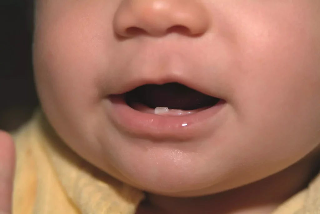 Quel est l'ordre de poussée des dents chez les enfants 3 Quel est l’ordre de poussée des dents chez les enfants
